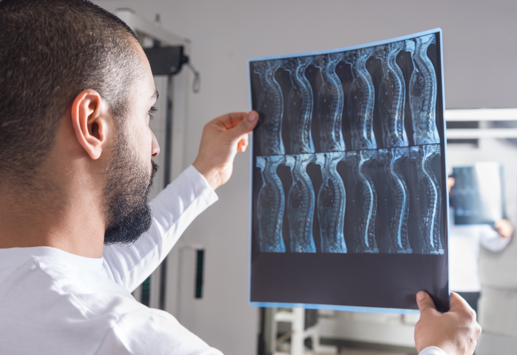 Un hombre con barba sostiene y examina unas radiografías de la columna vertebral, observando con atención las imágenes en un entorno médico.